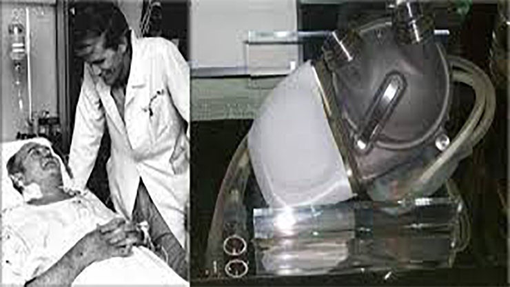 On This Day: February 19, 1985 William J. Schroeder Became the Second Human to Receive an Artificial Heart